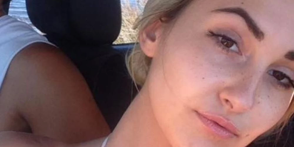 Προσοχή, σκληρές εικόνες! Πήγε να χαϊδέψει σκύλο κι εκείνος της κομμάτιασε το πρόσωπο